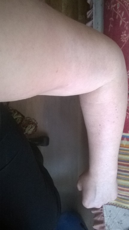 reka ubytek tłuszczu