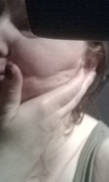 twarz defizyty tłuszczu